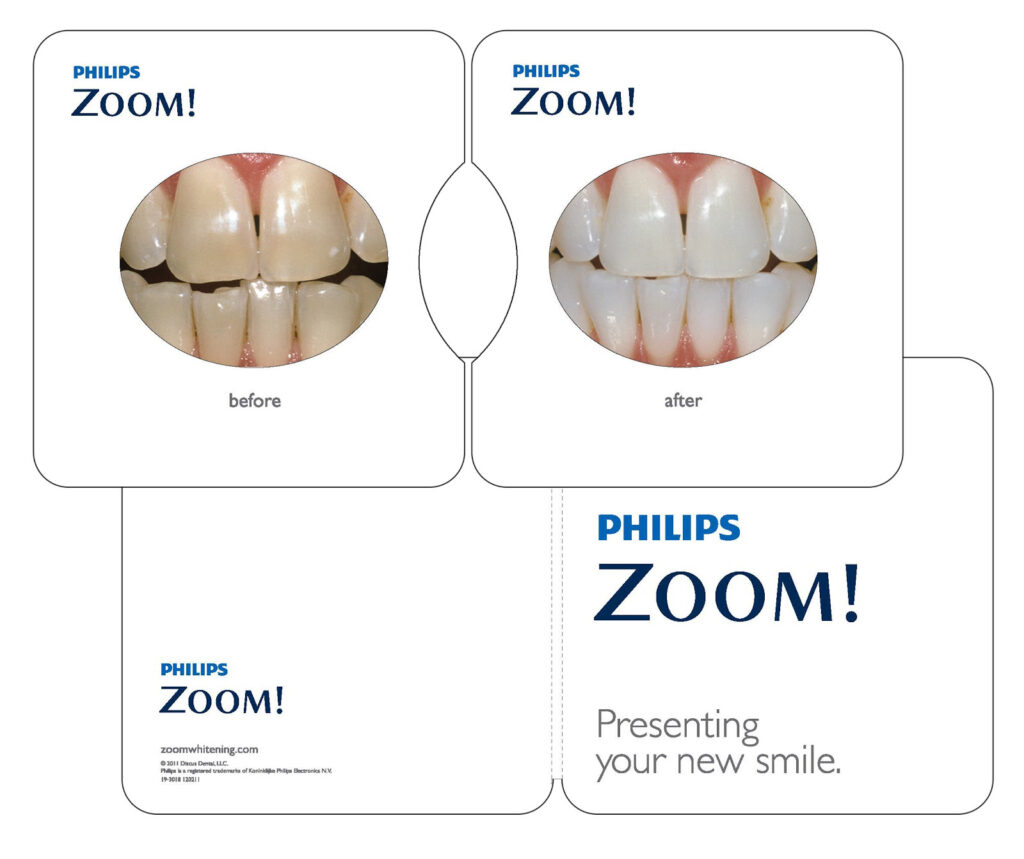 คลินิก-ทันตกรรม-ดิไอวรี่-ฟอกสีฟัน-ฟอกฟันขาว-Zoom-ตัวอย่าง