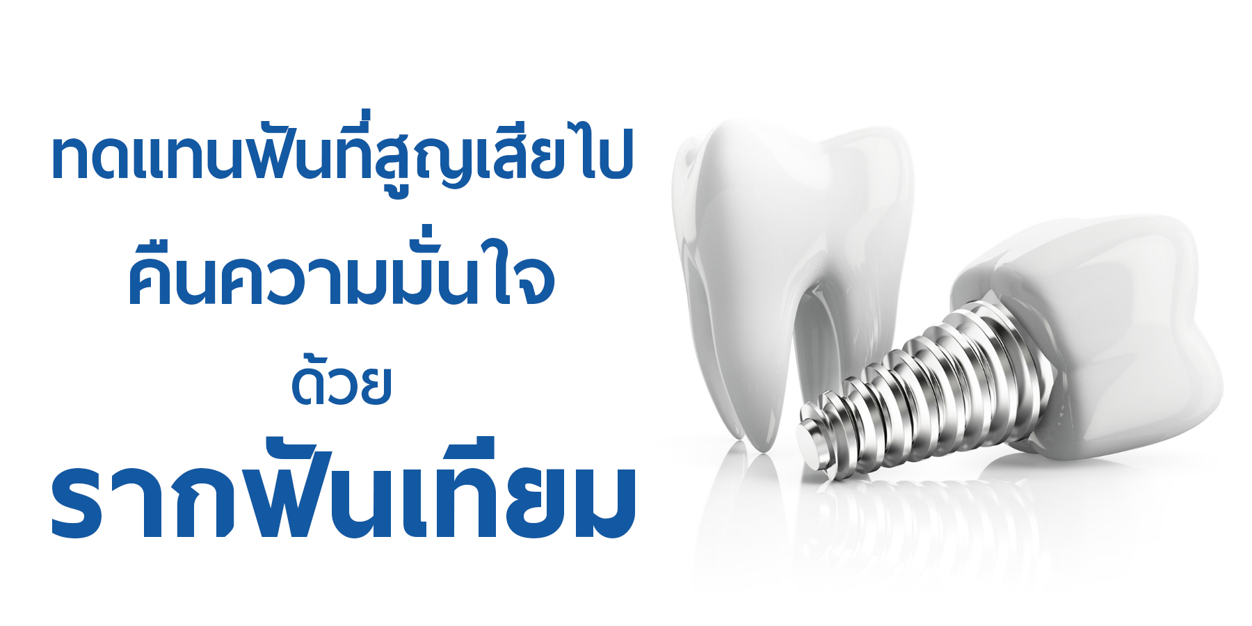 ทดแทนฟันที่สูญเสียไปด้วยรากฟันเทียม - The Ivory Dental Clinic
