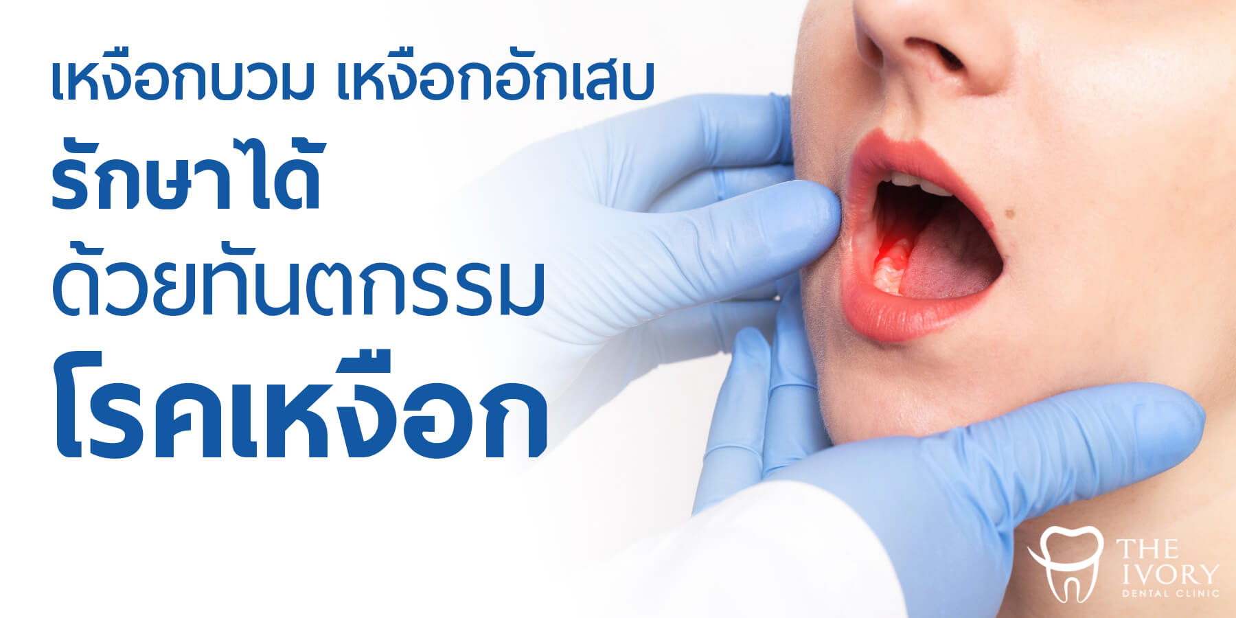 ทันตกรรมโรคเหงือก - The Ivory Dental Clinic ปรึกษาฟรี