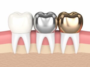 Dental crown cost thailand